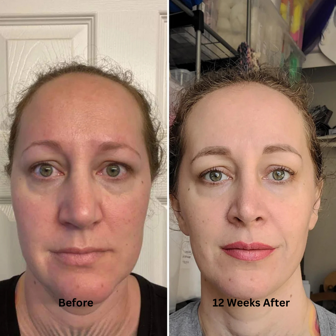 Norberla Anti-Aging Serum